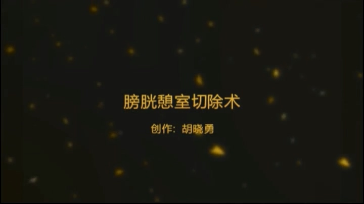 膀胱憩室切除术