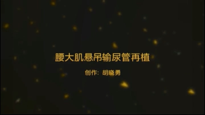 腰大肌悬吊输尿管再植术