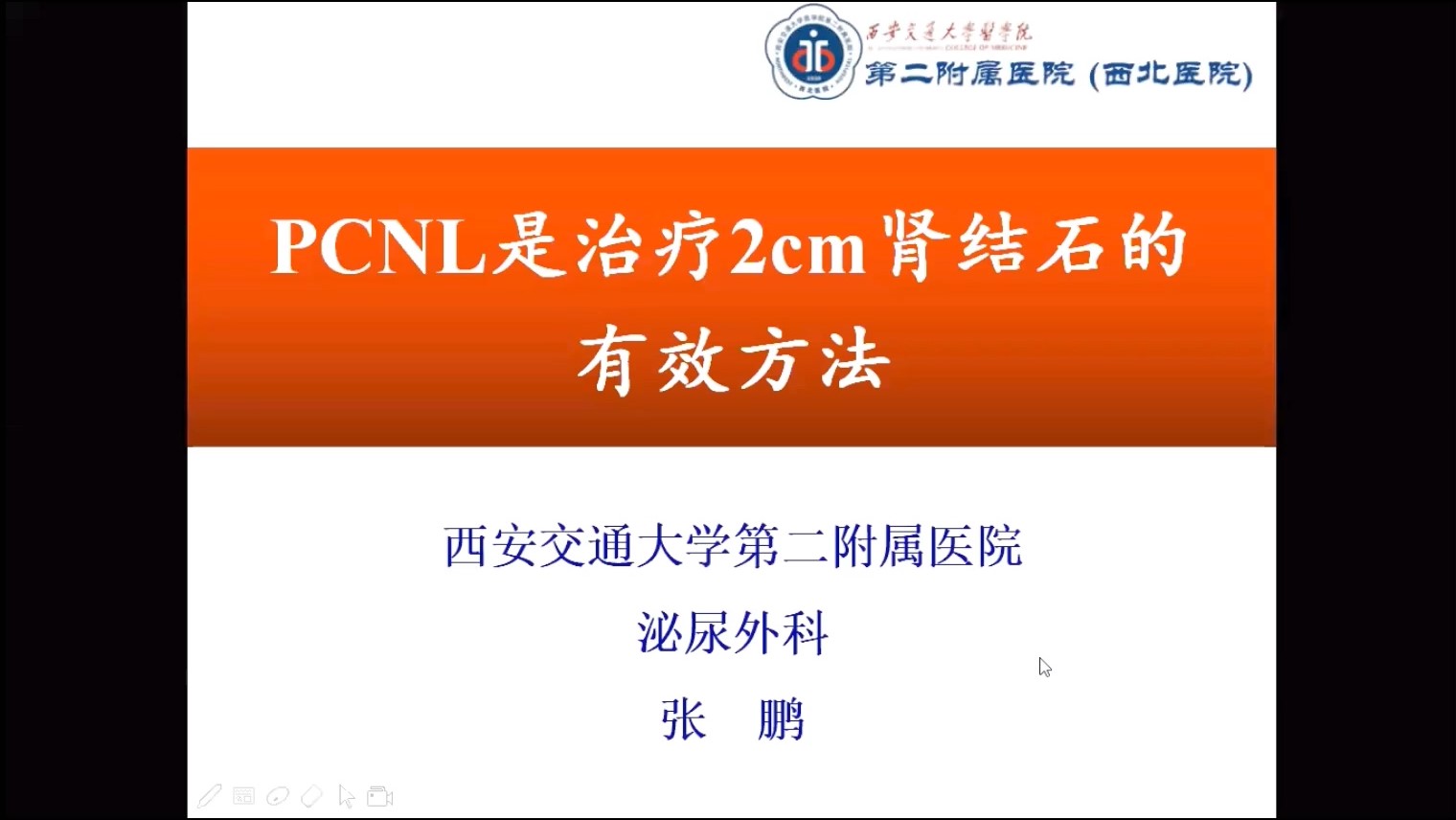 第209期 2cm肾结石的治疗——PCNL篇