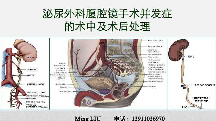 第171期 泌尿外科腹腔镜手术并发症的术中及术后处理