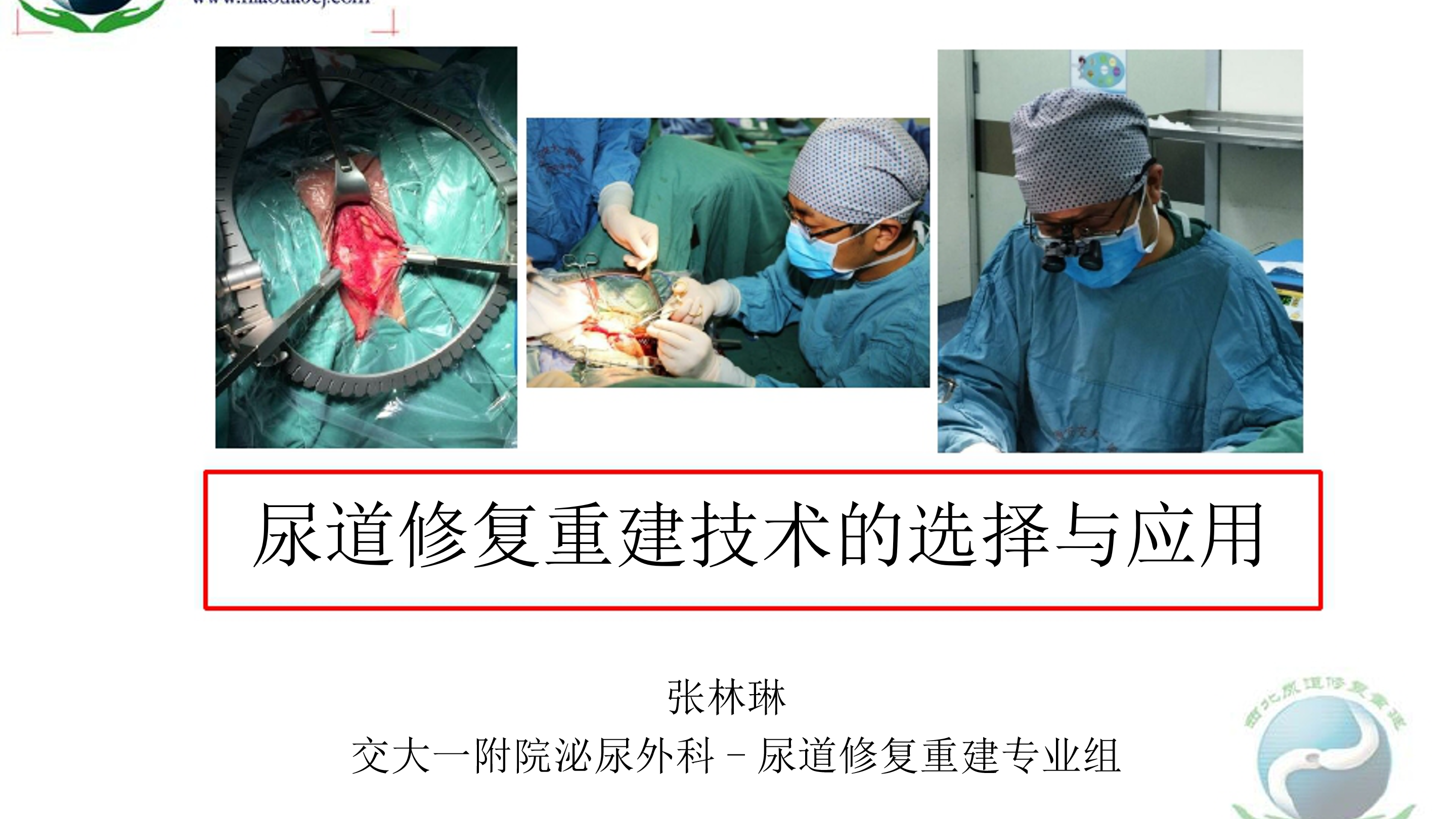 第5期 张林琳|尿道修复重建技术的选择与应用