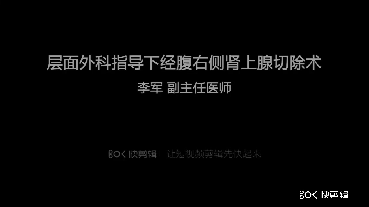 层面外科指导下经腹右侧肾上腺切除术