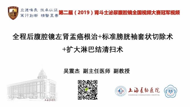 全程后腹腔镜左肾盂癌根治术+标准膀胱袖切+扩大淋巴结清扫术