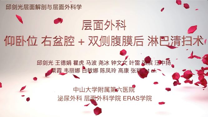 层面外科仰卧位右侧盆腔淋巴清扫加双侧腹膜后淋巴清扫术