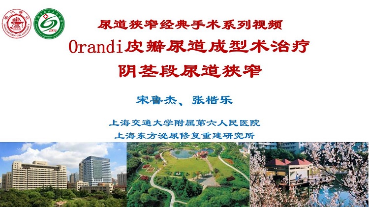 Orandi皮瓣尿道成形术治疗阴茎段尿道狭窄