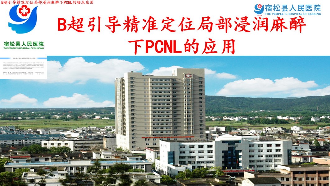 B超引导精准定位局部浸润麻醉下PCNL的应用体会