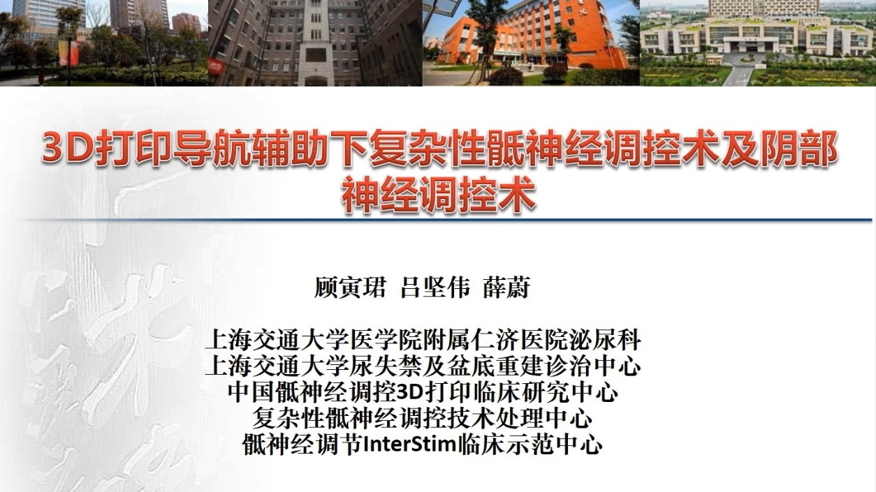3D打印导航辅助下复杂性骶神经调控术及阴部神经调控术