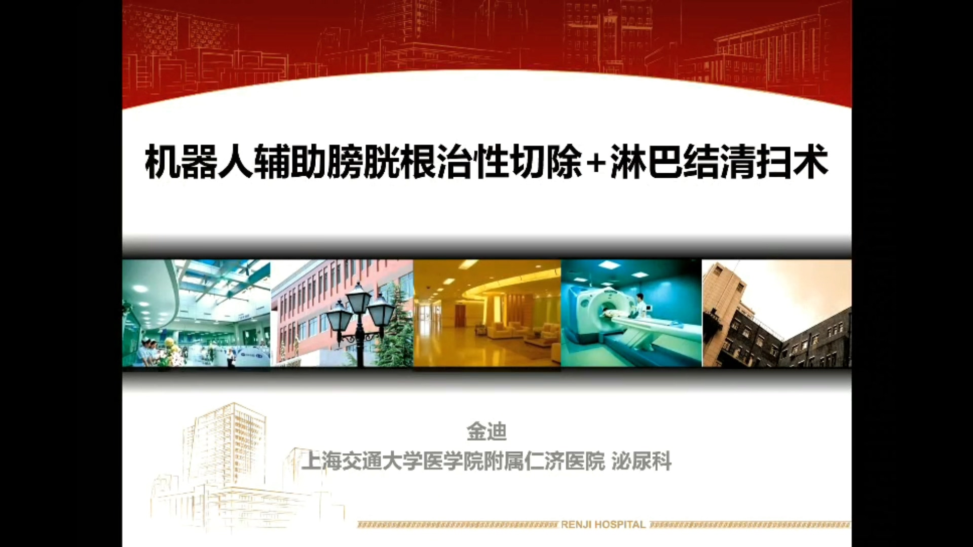 机器人辅助膀胱根治性切除加盆腔扩大淋巴结清扫术