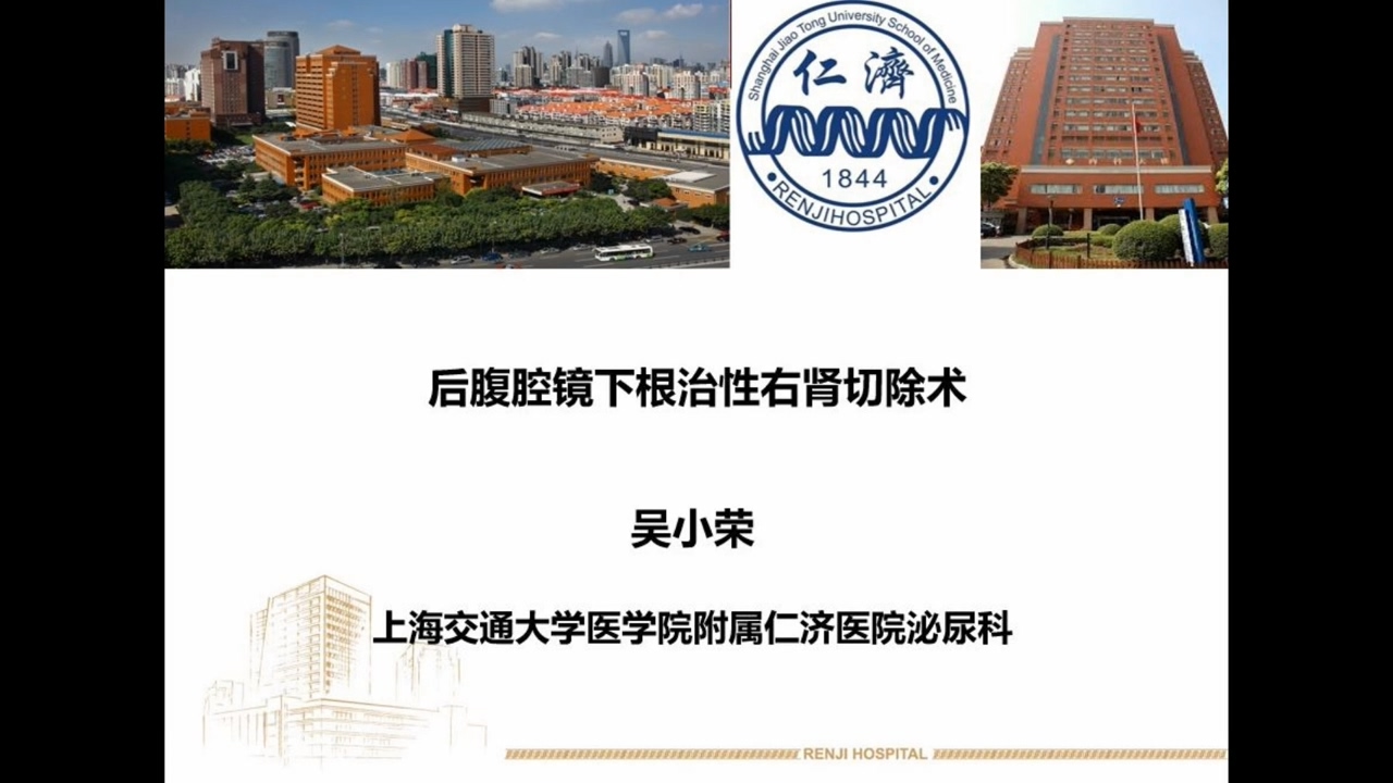 后腹腔镜下根治性右肾切除术
