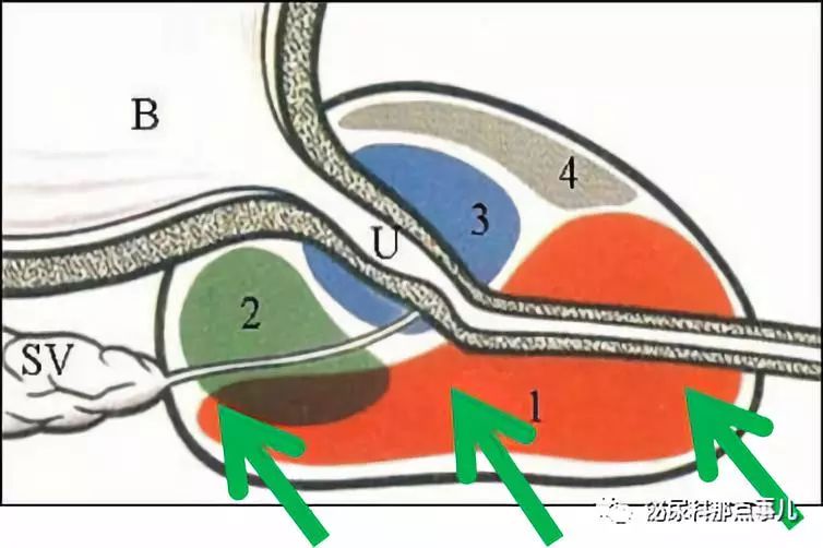 1557192896975917.jpg