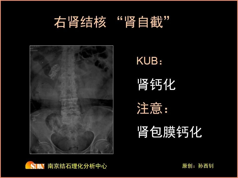 1557215746910776.png image.png