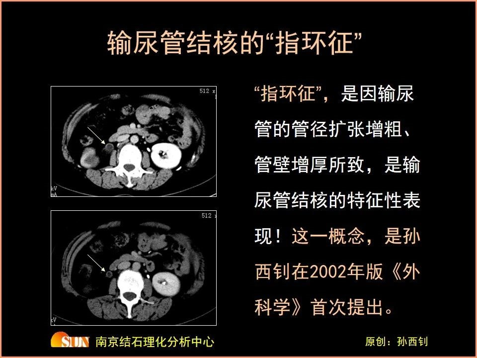 1557215990329814.png image.png