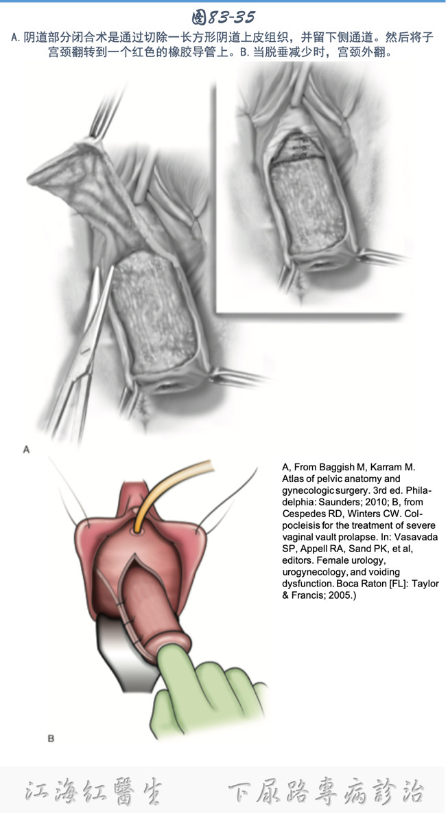 1581298350676506.png image.png