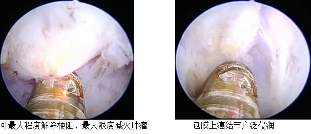 1584082102742214.png image.png