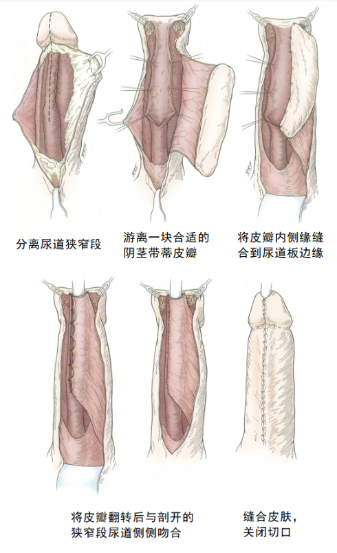 1587713692340693.png image.png