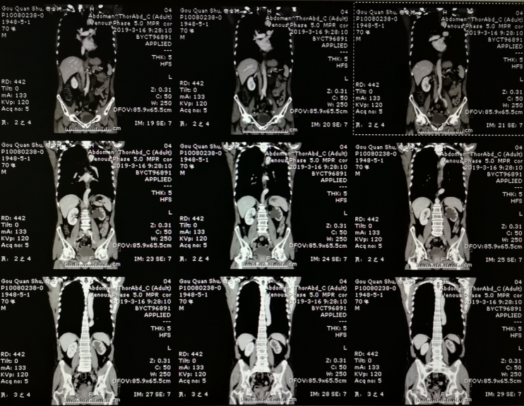 1590376356129214.png image.png