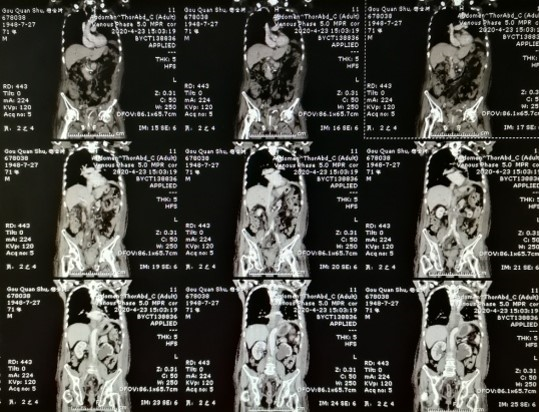 1590376467921126.png image.png