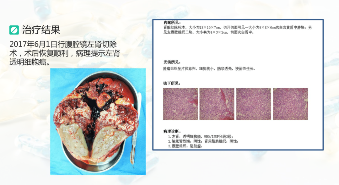 1591587881359607.png image.png