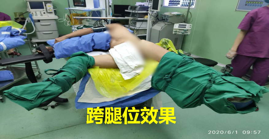 1591690265258917.png image.png