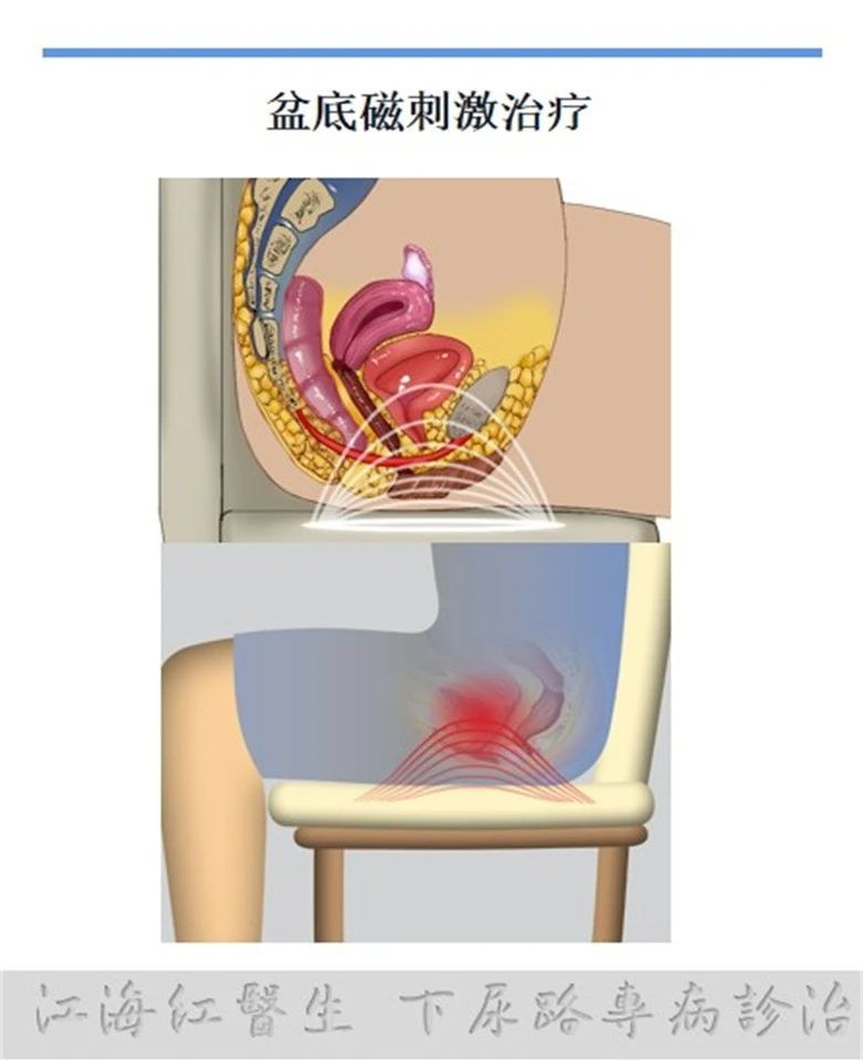 1601429808237851.png image.png