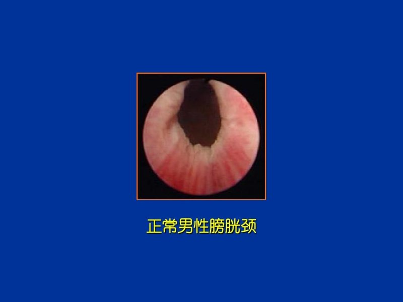 1605578412165443.png image.png