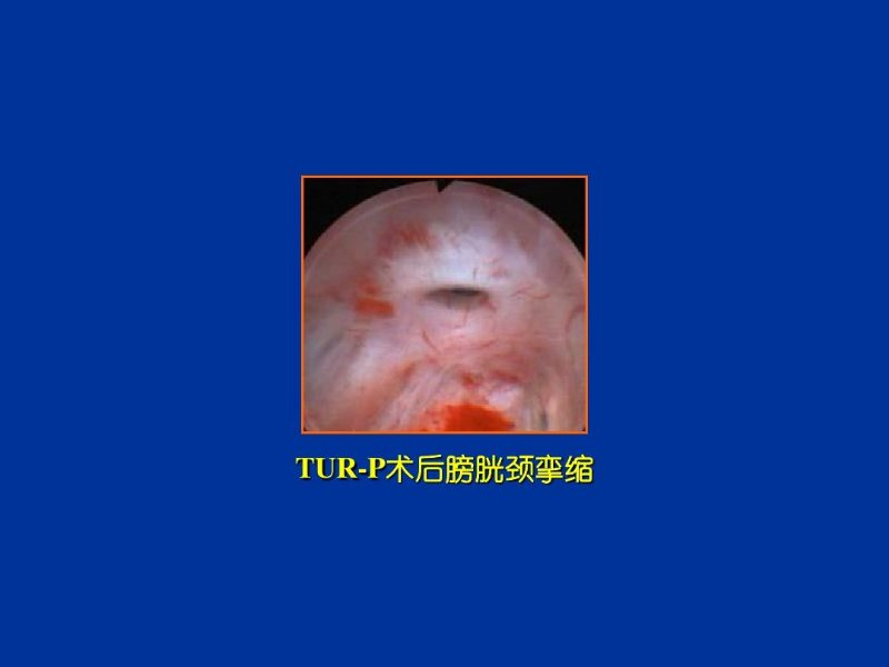1605578418144152.png image.png