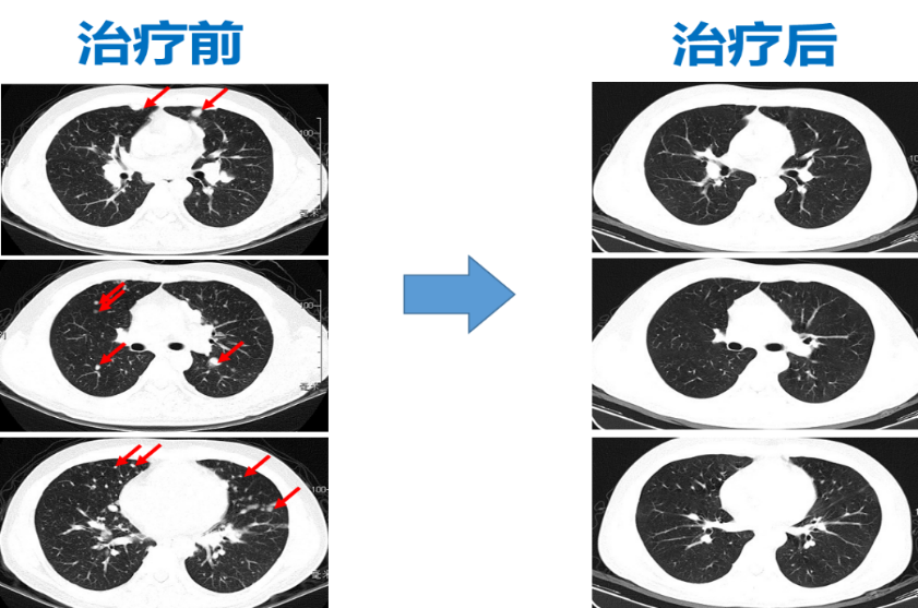 1605594981657994.png image.png