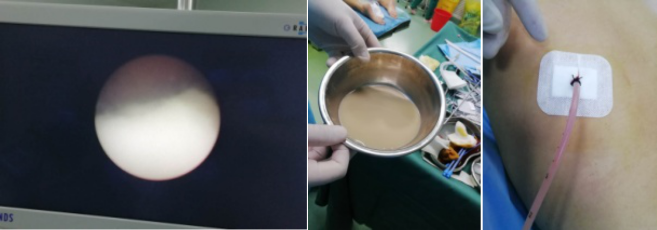 1607478320544804.png image.png