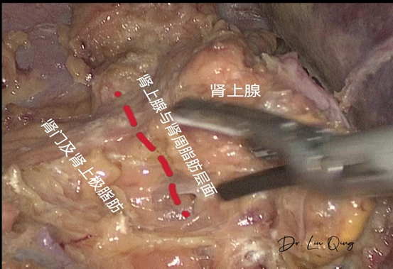 1616482803625594.png 640 (8).png