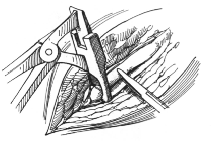 1619744719628707.png 2.png
