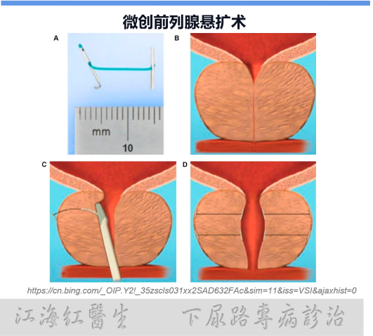1621218184686175.png 5.png
