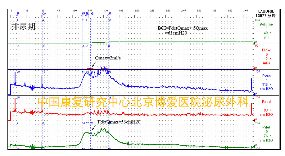 1621390182166198.png 7.png