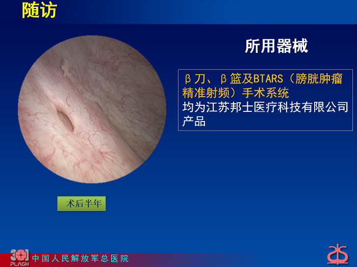 孙圣坤 保卫膀胱——β刀切除输尿管口周围肿瘤2.png