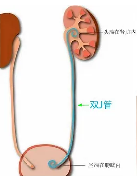 1665368719991999.png 640 (1).png
