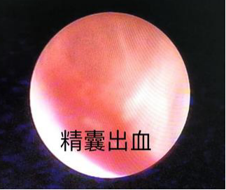 1669942366412564.png 640.png