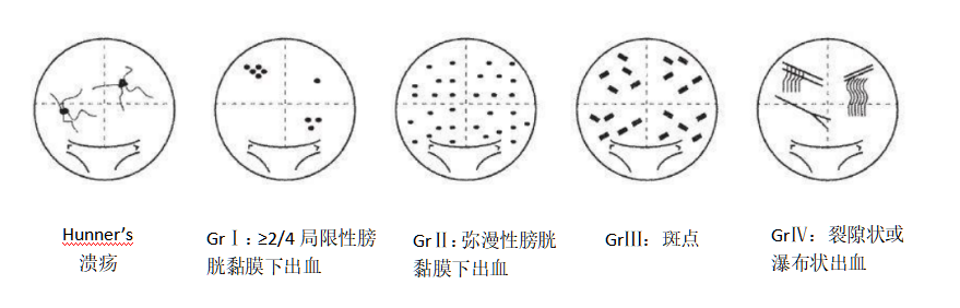 1680599494150698.png 分类.png