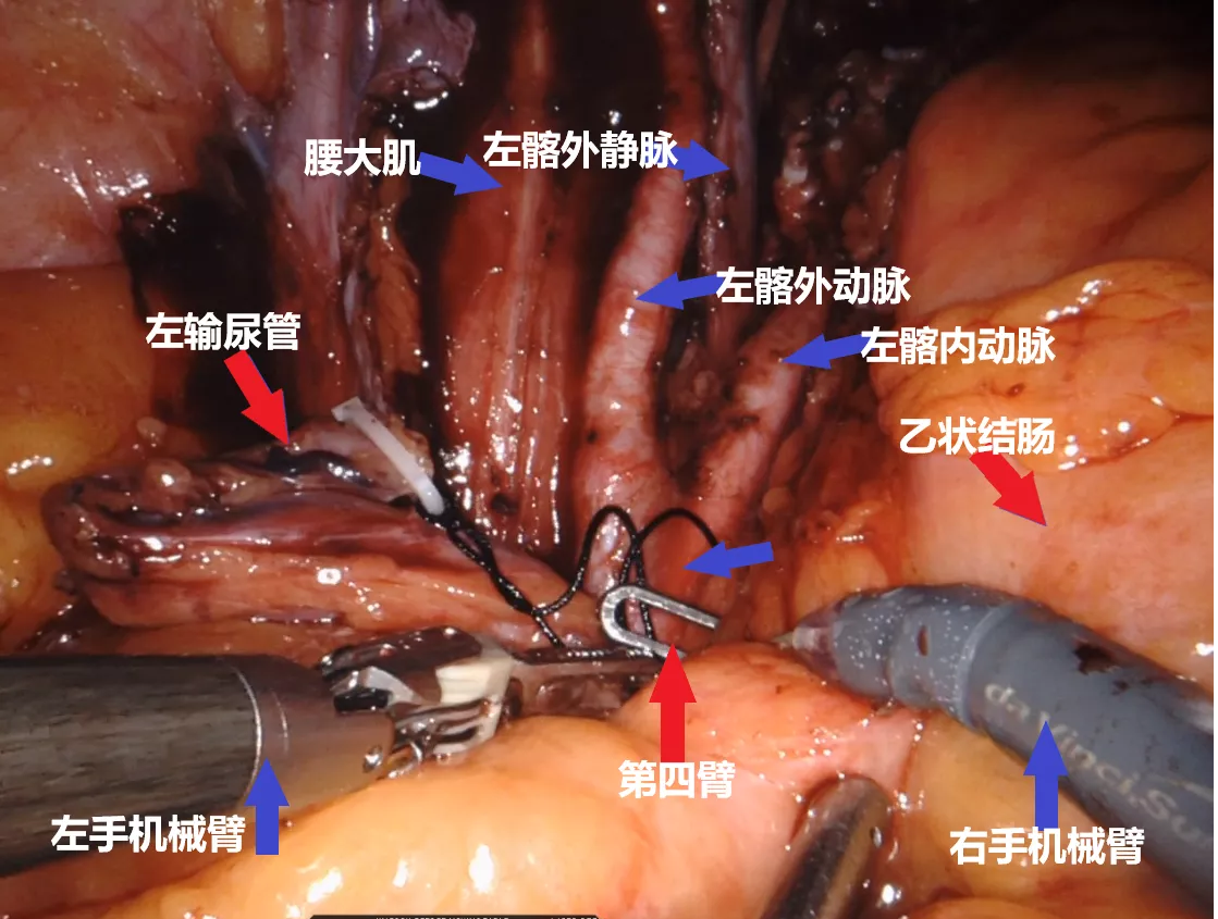 图片12.png