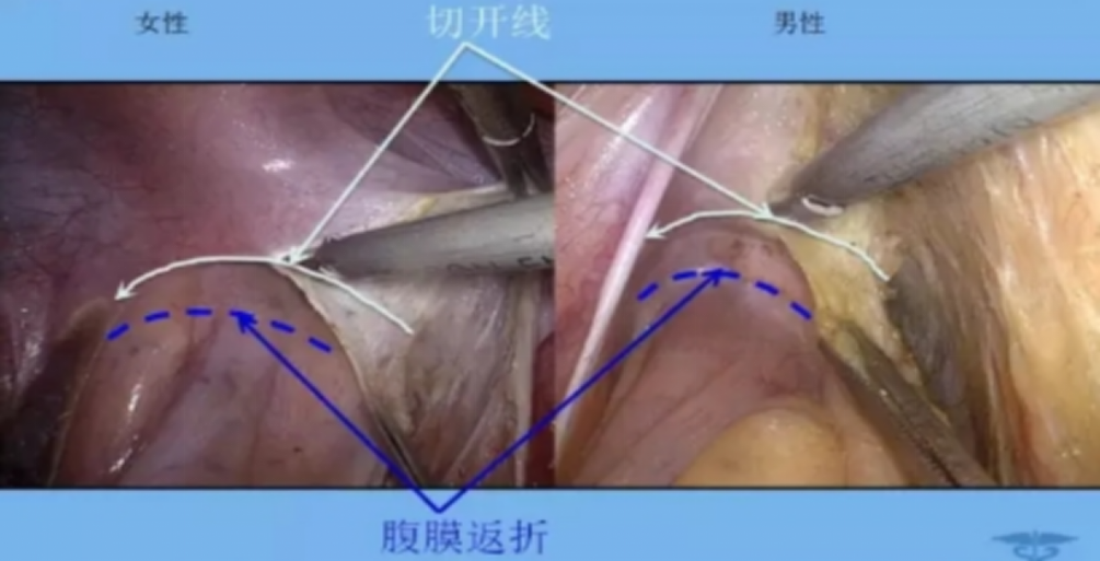 图片32.png