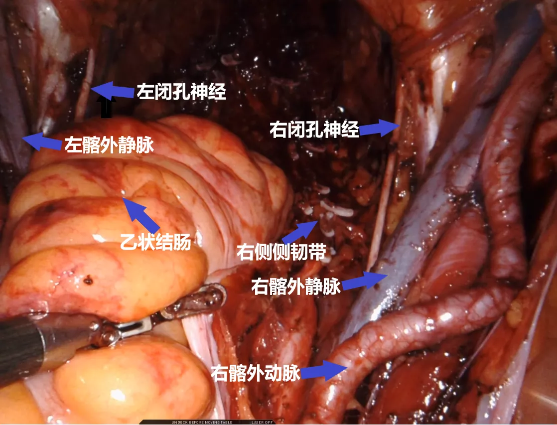 图片47.png