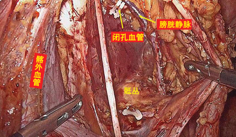 图片53.png