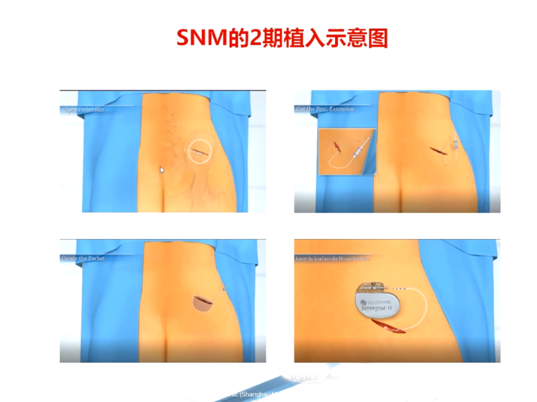 微信图片_20230811113549_1.png