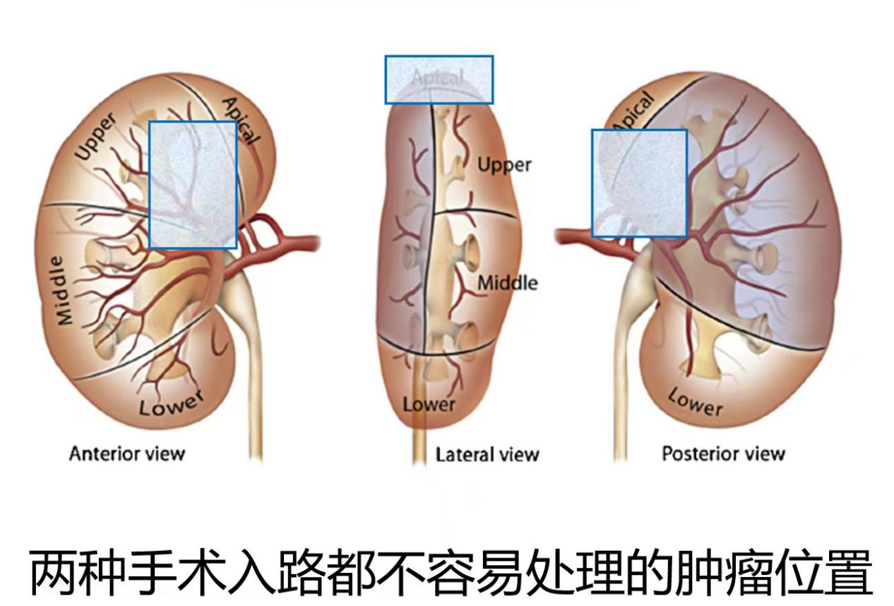 1693964315354704.png 图片11.png