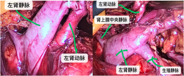 1693964415306448.png 图片20.png