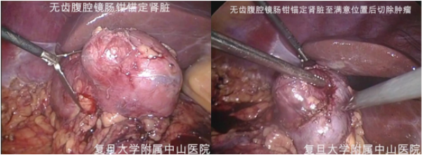 1693964433517808.png 图片21.png