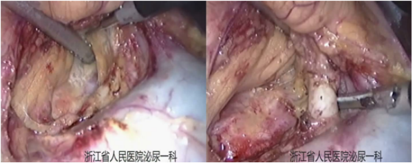 1693964517538505.png 图片30.png