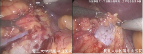 1693964536400787.png 图片33.png