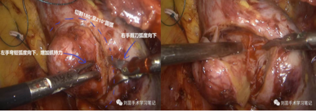 1693965160883993.png 图片62.png