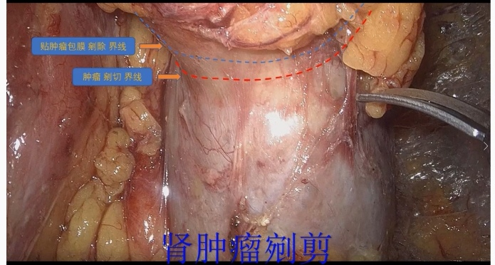 1693965486153433.png 图片63.png