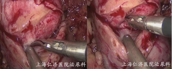 1693966807868853.png 图片80.png