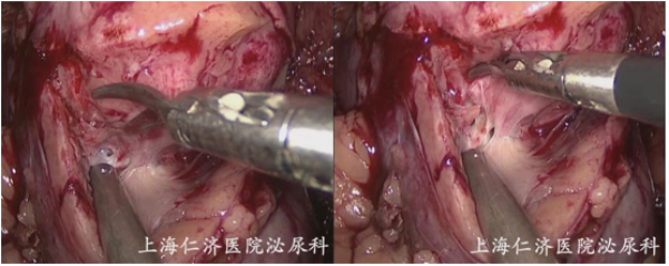 1693966818451649.png 图片81.png